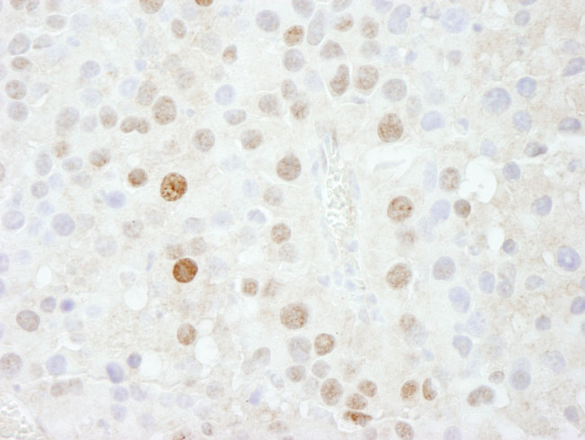 FOXK1 Antibody in Immunohistochemistry (Paraffin) (IHC (P))