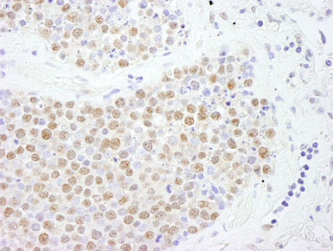 FOXK2 Antibody in Immunohistochemistry (Paraffin) (IHC (P))