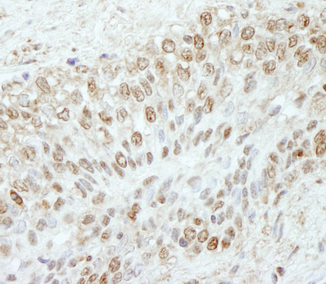 WDR91 Antibody in Immunohistochemistry (Paraffin) (IHC (P))
