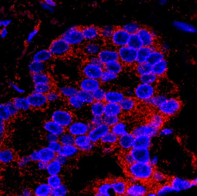 Flightless-1 Antibody in Immunohistochemistry (Paraffin) (IHC (P))