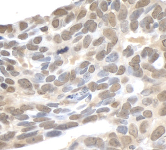 XPA Antibody in Immunohistochemistry (Paraffin) (IHC (P))