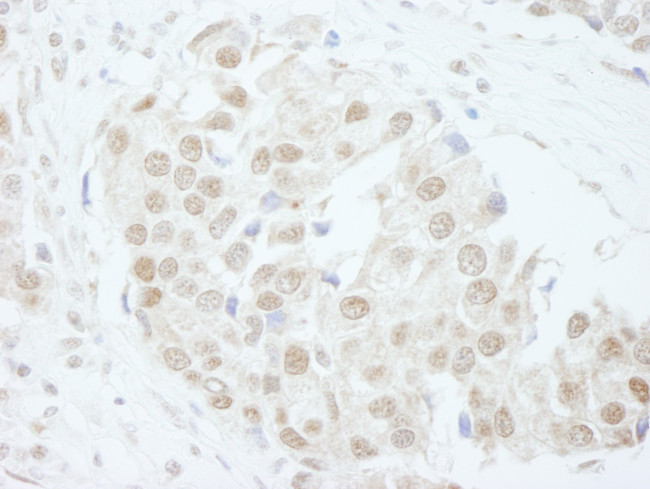 PUS1 Antibody in Immunohistochemistry (Paraffin) (IHC (P))