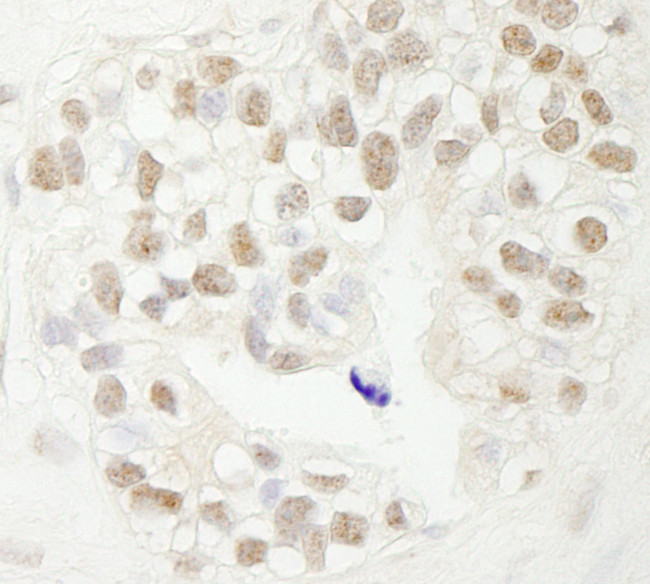 FBW7 Antibody in Immunohistochemistry (Paraffin) (IHC (P))