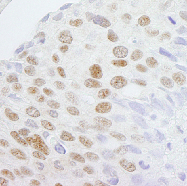 ZCCHC8 Antibody in Immunohistochemistry (Paraffin) (IHC (P))
