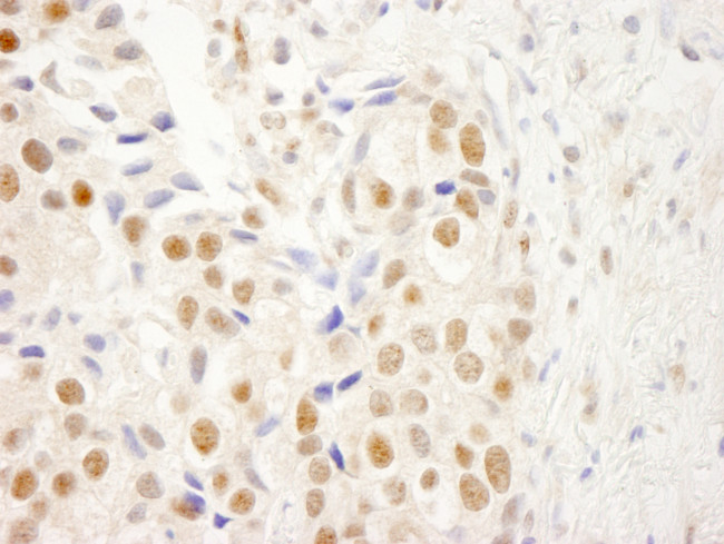 NRBF2 Antibody in Immunohistochemistry (Paraffin) (IHC (P))