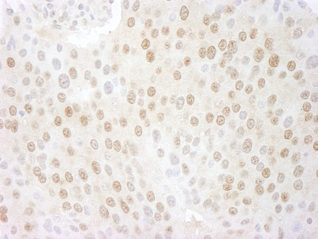 CSN5 Antibody in Immunohistochemistry (Paraffin) (IHC (P))