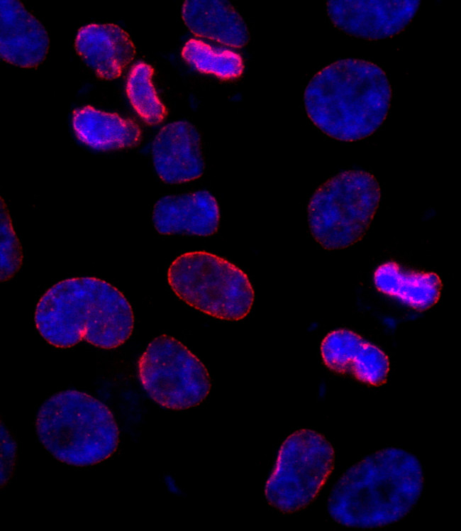 NUP153 Antibody in Immunocytochemistry (ICC/IF)