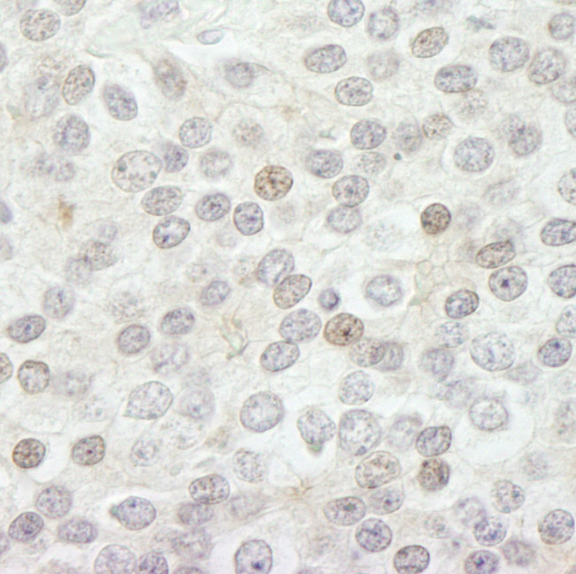 JARID1B Antibody in Immunohistochemistry (Paraffin) (IHC (P))