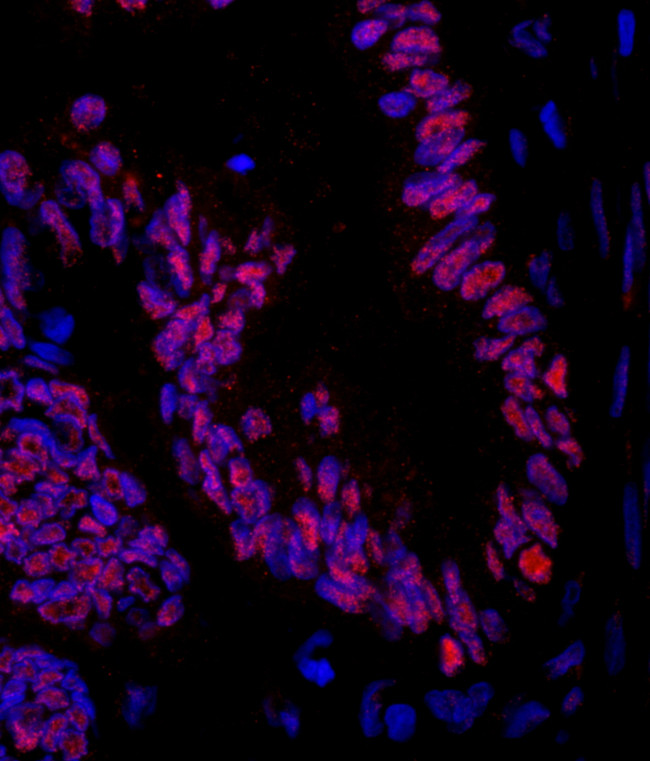 ZNF326 Antibody in Immunohistochemistry (Paraffin) (IHC (P))