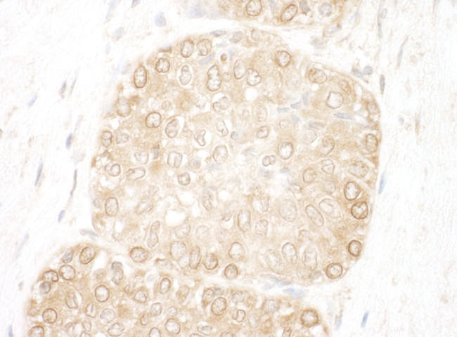 WDFY3 Antibody in Immunohistochemistry (Paraffin) (IHC (P))
