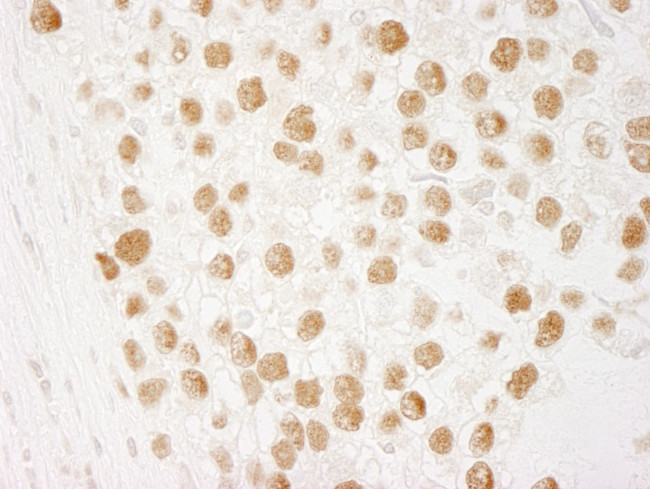 CTF18 Antibody in Immunohistochemistry (Paraffin) (IHC (P))