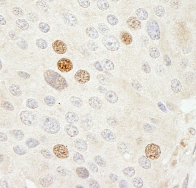 CDK2 Antibody in Immunohistochemistry (Paraffin) (IHC (P))