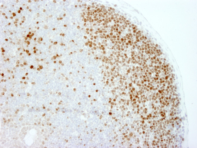 Ki-67 Antibody in Immunohistochemistry (Paraffin) (IHC (P))