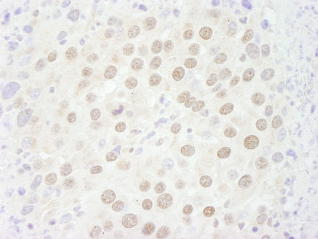 p66beta/GATAD2B Antibody in Immunohistochemistry (Paraffin) (IHC (P))