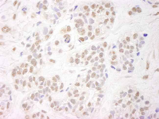 NELFA Antibody in Immunohistochemistry (Paraffin) (IHC (P))