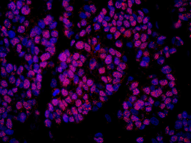COBRA1 Antibody in Immunohistochemistry (Paraffin) (IHC (P))