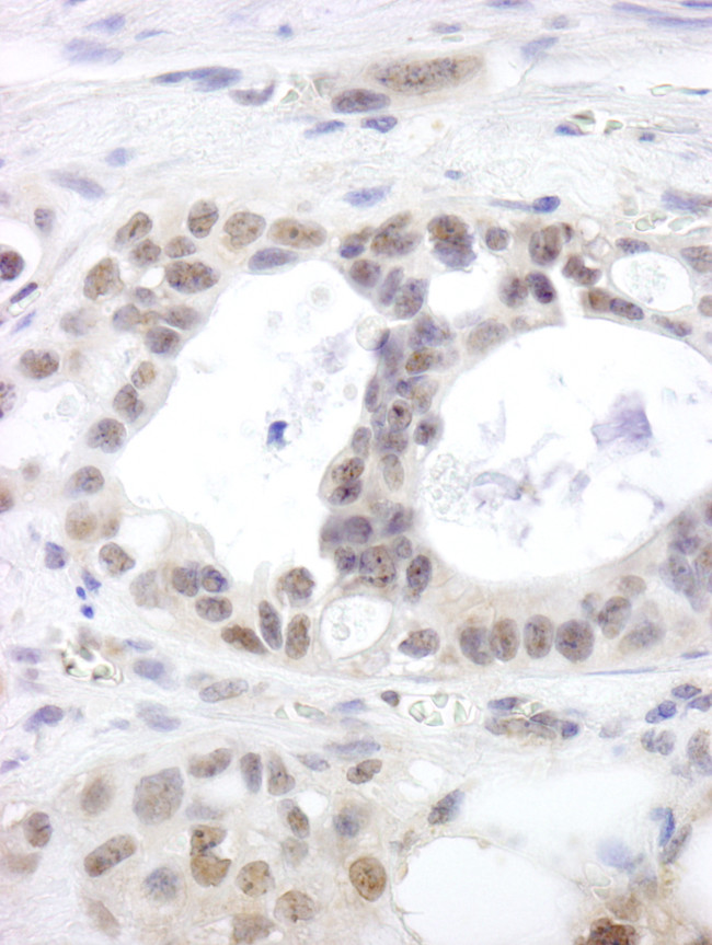 DHX15 Antibody in Immunohistochemistry (Paraffin) (IHC (P))