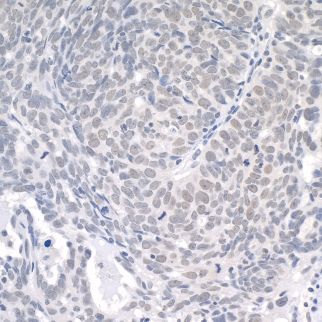 USP1 Antibody in Immunohistochemistry (Paraffin) (IHC (P))
