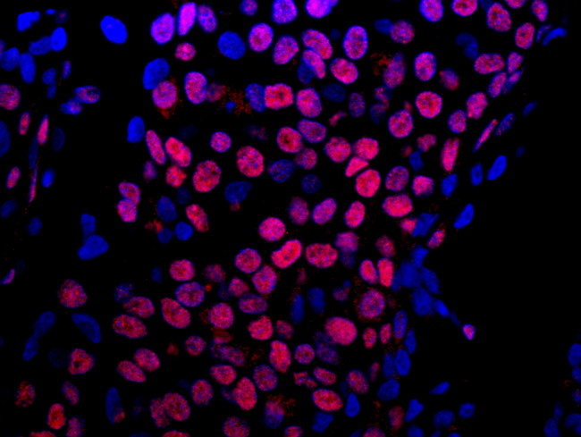 E1B-AP5 Antibody in Immunohistochemistry (Paraffin) (IHC (P))
