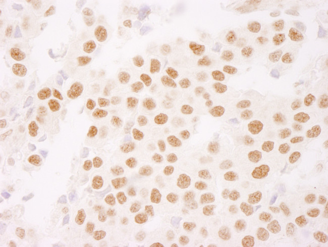 Ki-67 Antibody in Immunohistochemistry (Paraffin) (IHC (P))