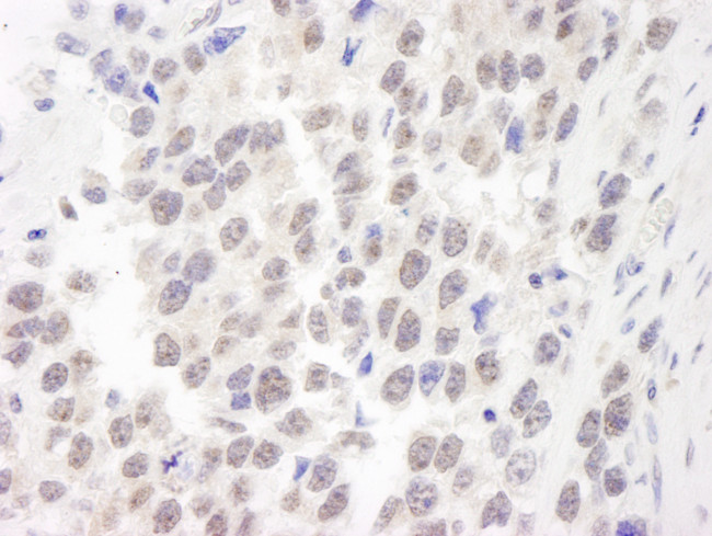 WRN Antibody in Immunohistochemistry (Paraffin) (IHC (P))