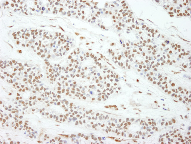 MAD2 Antibody in Immunohistochemistry (Paraffin) (IHC (P))