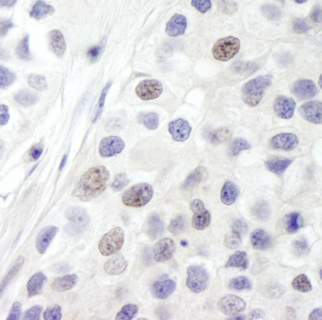 INT8 Antibody in Immunohistochemistry (Paraffin) (IHC (P))