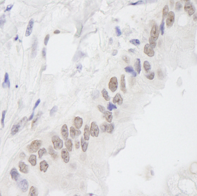 EMSY Antibody in Immunohistochemistry (Paraffin) (IHC (P))