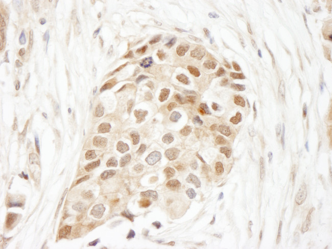 Ubiquitin Antibody in Immunohistochemistry (Paraffin) (IHC (P))