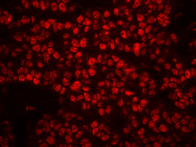 Phospho-RPA32 (Ser4, Ser8) Antibody in Immunohistochemistry (Paraffin) (IHC (P))