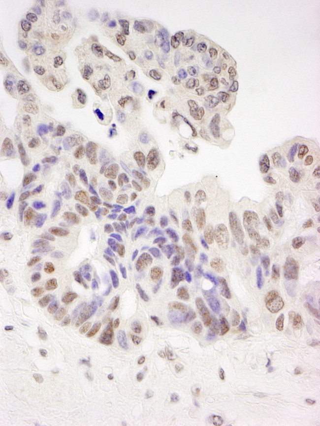 Tat-SF1 Antibody in Immunohistochemistry (Paraffin) (IHC (P))