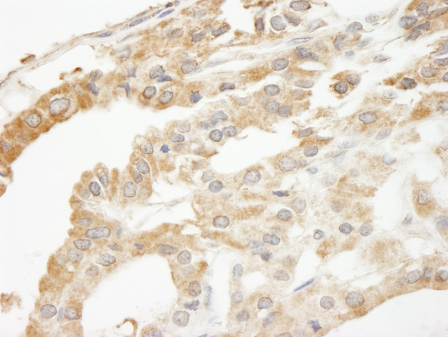 ABCF2 Antibody in Immunohistochemistry (Paraffin) (IHC (P))