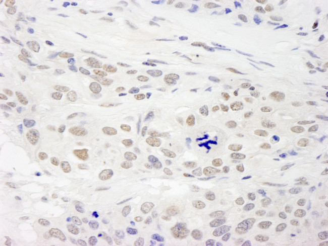 RAP1 Antibody in Immunohistochemistry (Paraffin) (IHC (P))