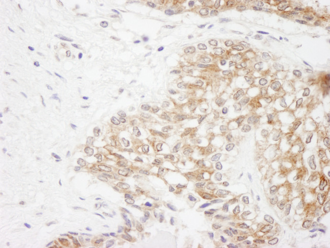 Rictor Antibody in Immunohistochemistry (Paraffin) (IHC (P))