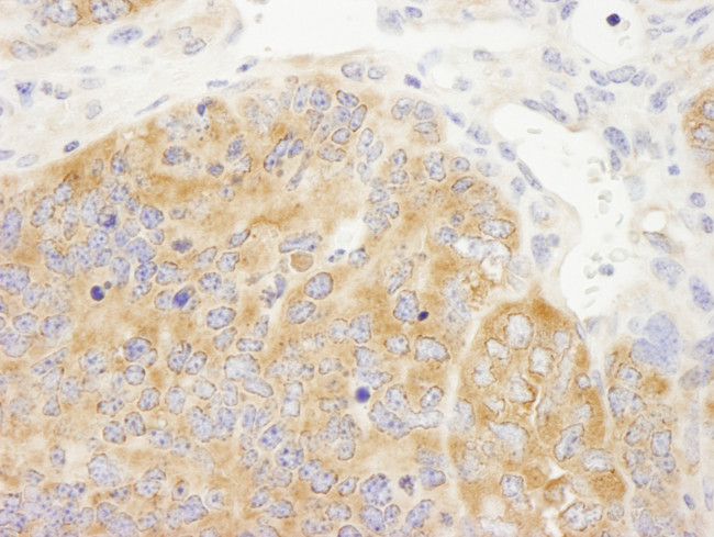 DDX6 Antibody in Immunohistochemistry (Paraffin) (IHC (P))