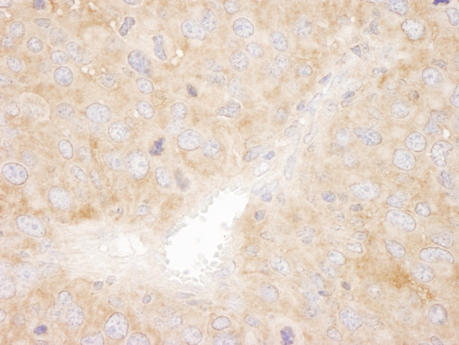 SNX1 Antibody in Immunohistochemistry (Paraffin) (IHC (P))