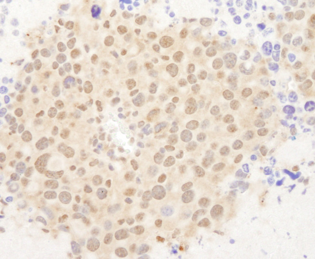 FOXO3a Antibody in Immunohistochemistry (Paraffin) (IHC (P))