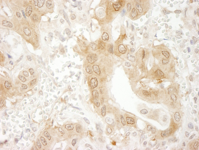 Paxillin Antibody in Immunohistochemistry (Paraffin) (IHC (P))