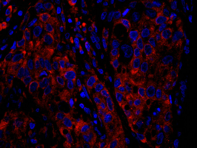 RPS6 Antibody in Immunohistochemistry (Paraffin) (IHC (P))