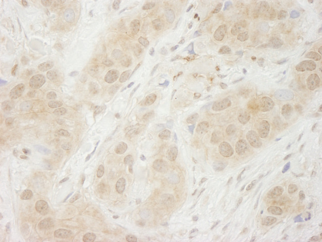 SYK Antibody in Immunohistochemistry (Paraffin) (IHC (P))