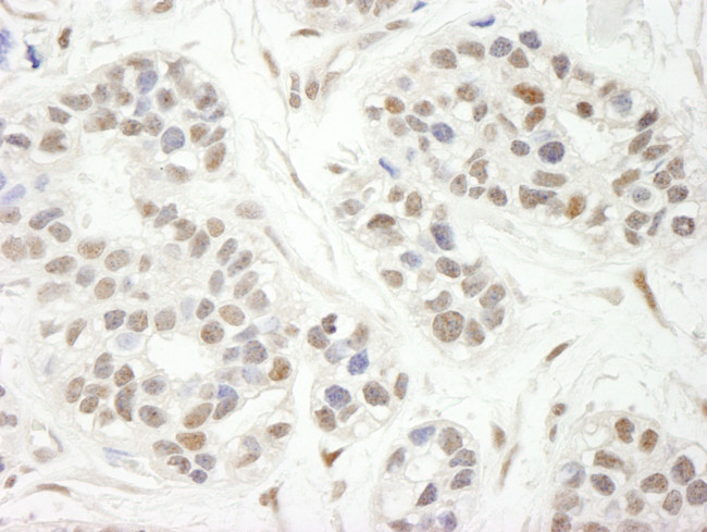 ZBTB7/FBI-1 Antibody in Immunohistochemistry (Paraffin) (IHC (P))
