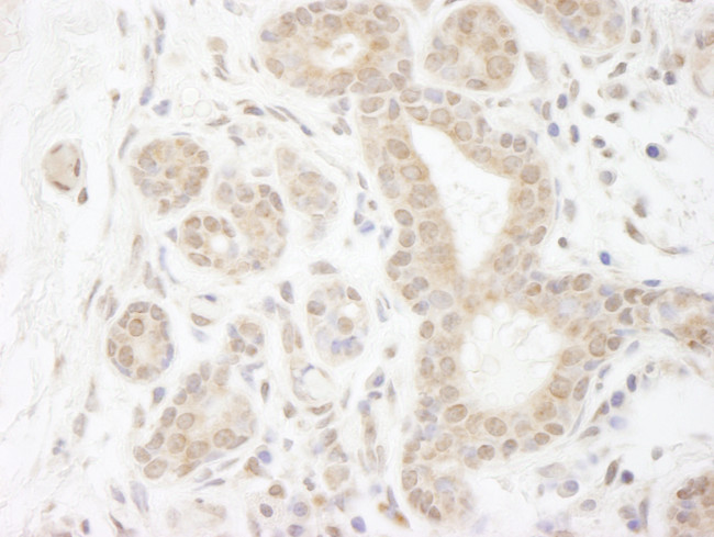 DDX20 Antibody in Immunohistochemistry (Paraffin) (IHC (P))