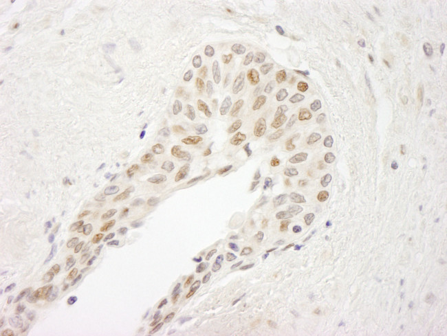 ATRIP Antibody in Immunohistochemistry (Paraffin) (IHC (P))