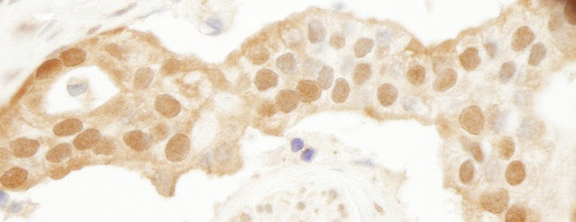 DJ-1 Antibody in Immunohistochemistry (Paraffin) (IHC (P))