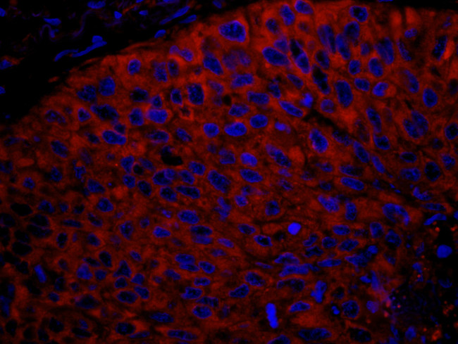 RPL7 Antibody in Immunohistochemistry (Paraffin) (IHC (P))