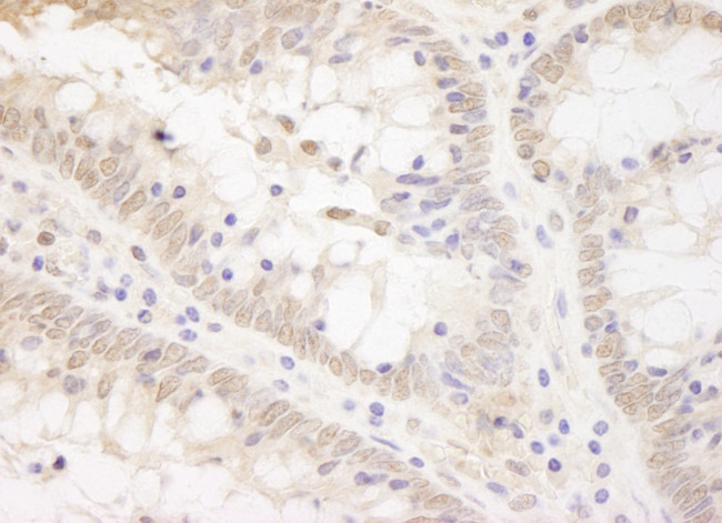 TCF12 Antibody in Immunohistochemistry (Paraffin) (IHC (P))