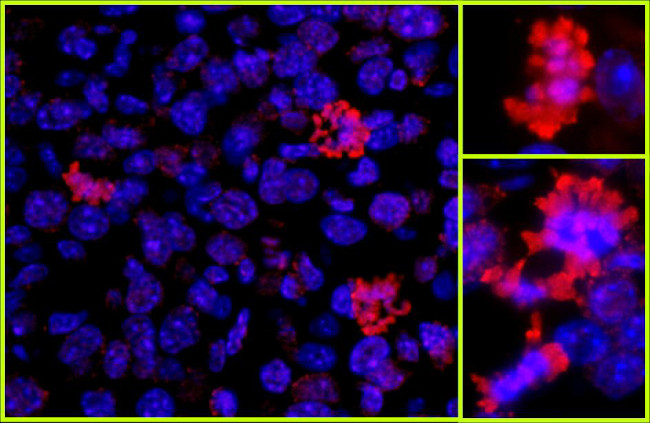 Histone H3 Antibody in Immunohistochemistry (Paraffin) (IHC (P))
