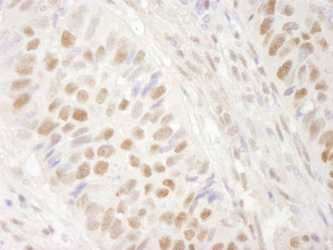 BRG1/SMARCA4 Antibody in Immunohistochemistry (Paraffin) (IHC (P))