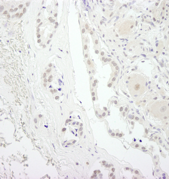 USP34 Antibody in Immunohistochemistry (Paraffin) (IHC (P))