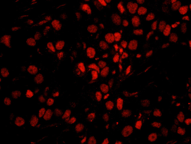PPP4R3 Alpha Antibody in Immunohistochemistry (Paraffin) (IHC (P))